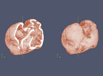 3D reconstruction of a non-adherent cell