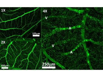 New resolutive imaging of fine tissue vasculature.