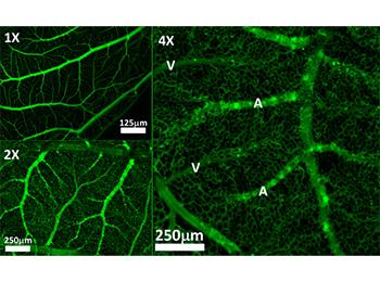 New Algorithm for Resolving Vascular Tissue Imaging