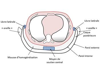 DEVICE FOR SELECTIVELY REGIONALIZING THE VENTILATION OF LUNGS BY EXTRATHORACIC NEGATIVE PRESSURE